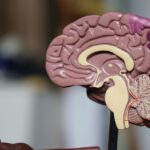 Dr. Kalil: Veja quais são os principais sintomas de tumores cerebrais